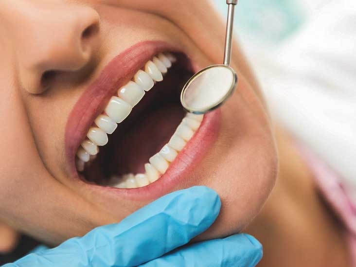 What Are the Common dental Problems – Know How to Prevent Them