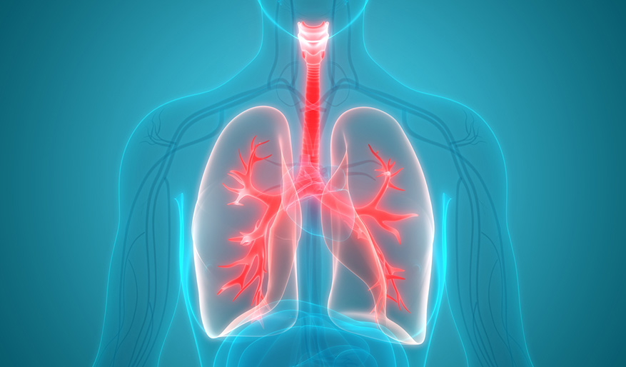 Facts About Lung Cancer
