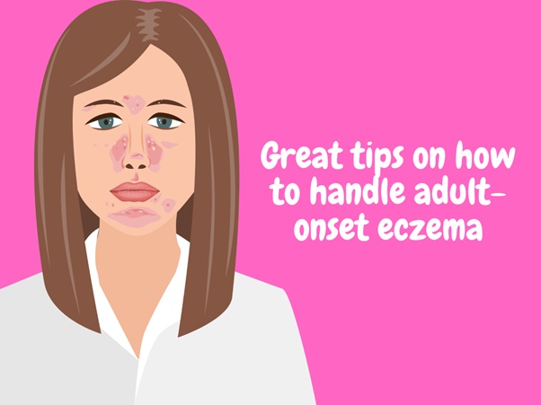 Great Tips On How To Handle Adult-onset Eczema
