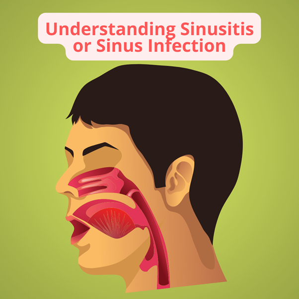    Sinusitis – A Serious Health & Sleep Concern