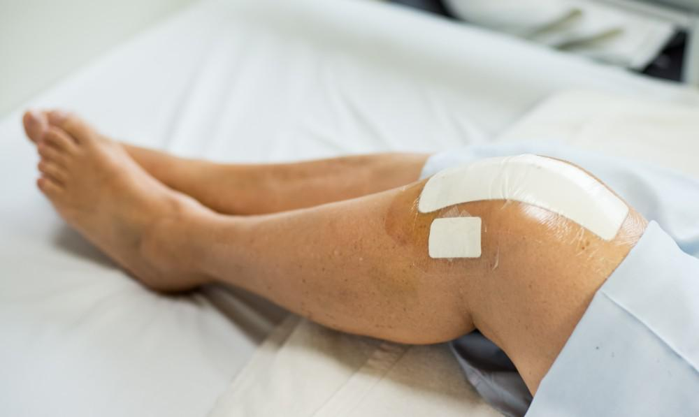 6 things to avoid post knee replacement surgery