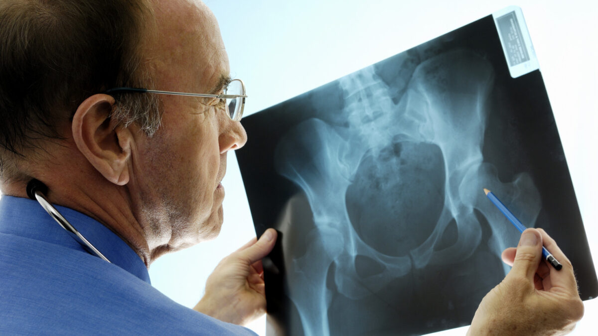 The Top 3 Reasons to Book an Appointment with an Orthopaedic Surgeon