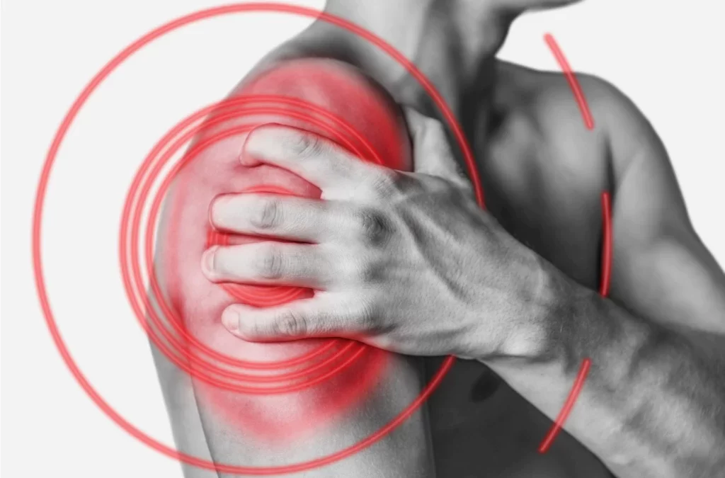 Why You Should Seek Help When Your Shoulder Pain Won’t Go Away