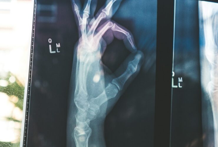 Health Technologies: Recent Innovations