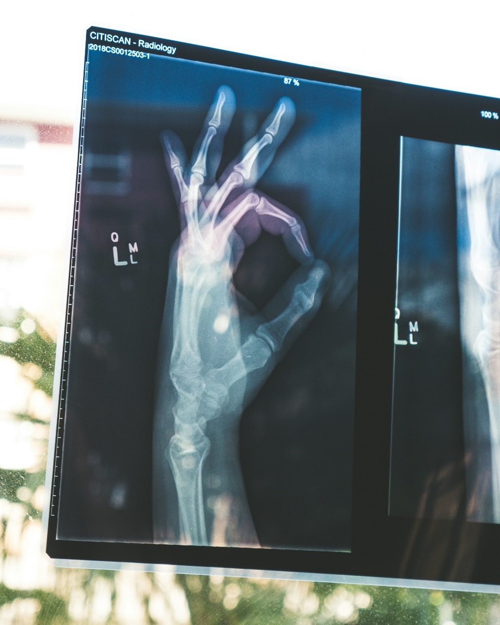 Health Technologies: Recent Innovations