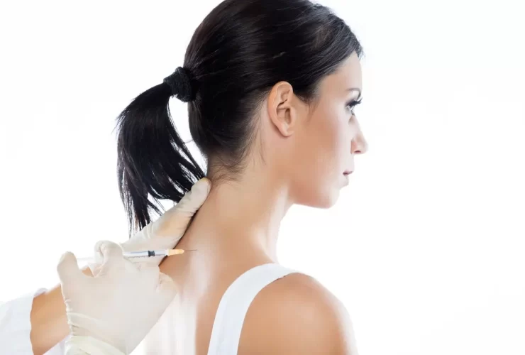 Botox for Trapezius